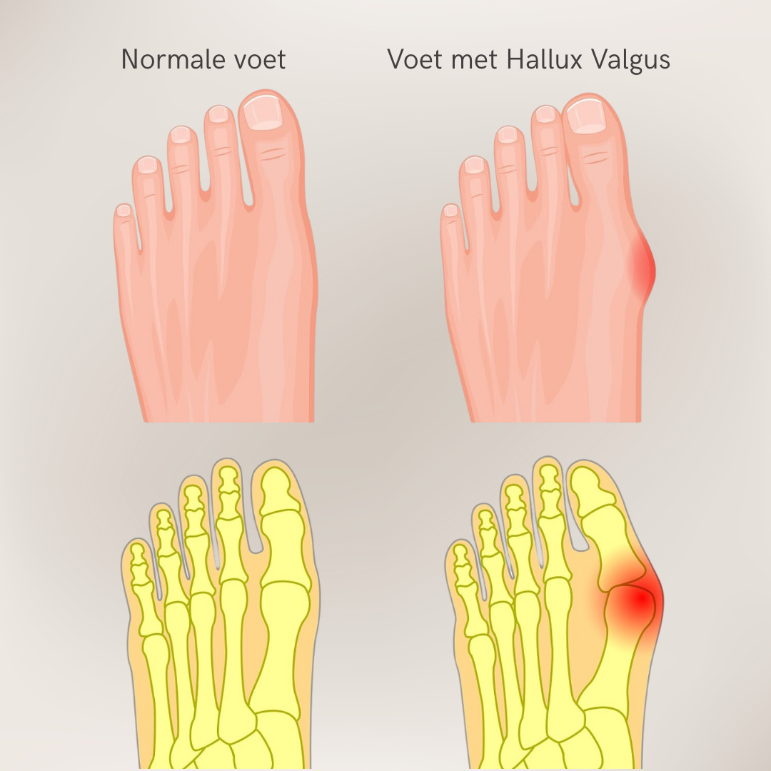 De TeenCorrector - Largazo.nl