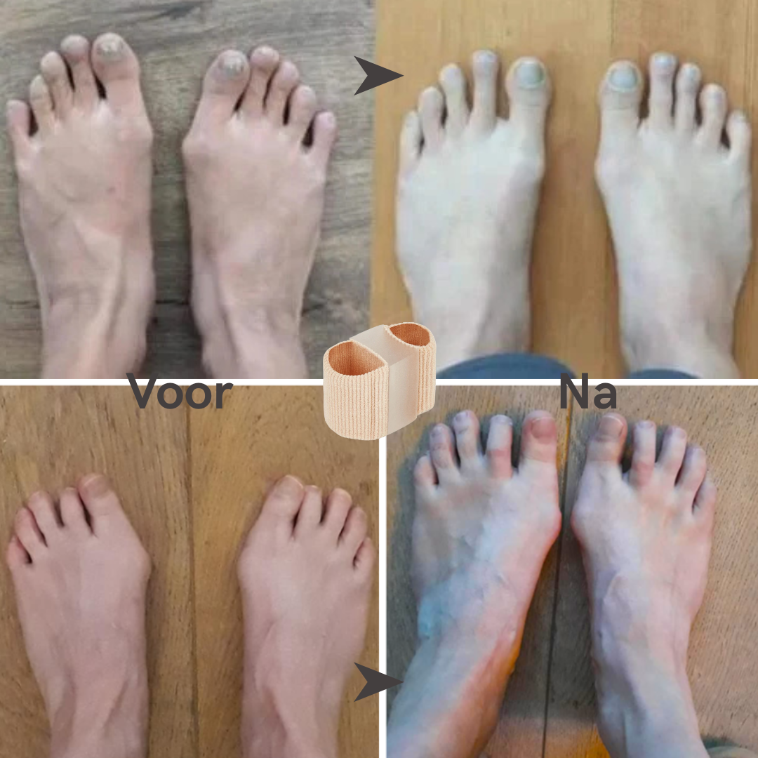 De TeenCorrector - Largazo.nl