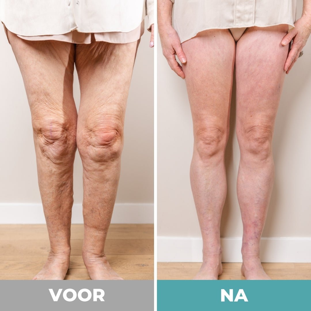 Voetmasseur - Largazo.nl