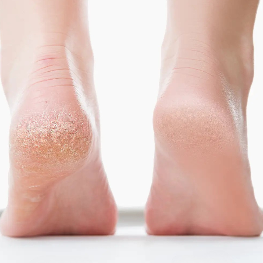 SilkCare Deluxe - Largazo.nl