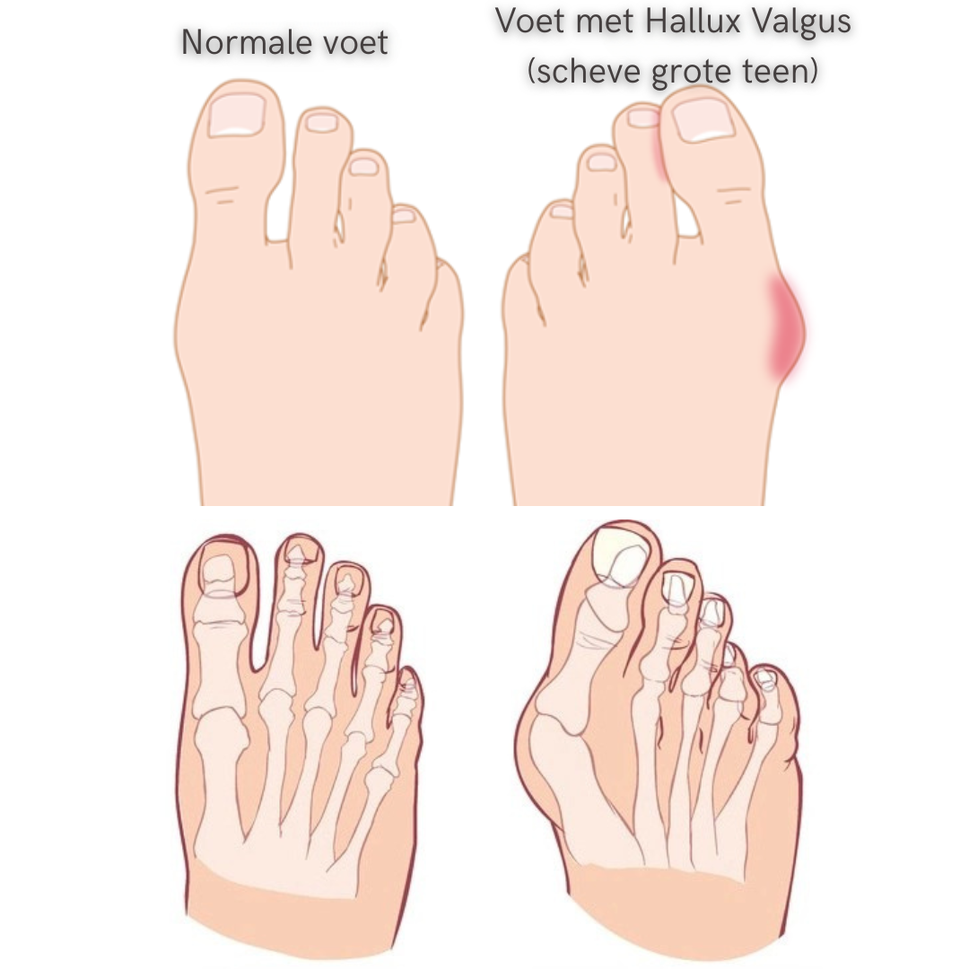 De TeenCorrector - Largazo.nl